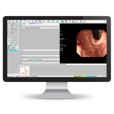 内镜科室信息综合管理系统